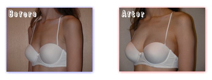 �o�X�g�A�b�v���@2